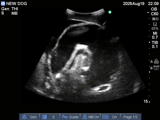 Ultrasound Scans
