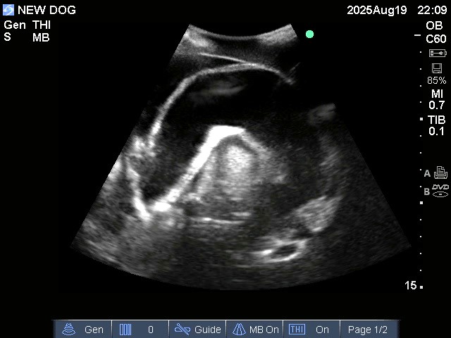 Ultrasound Scans