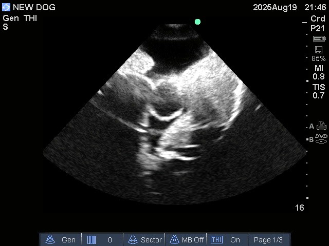 Ultrasound Scans