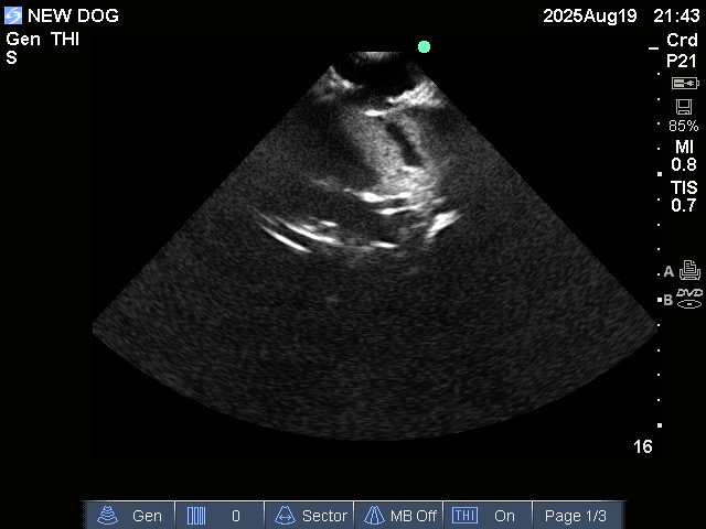Ultrasound Scans