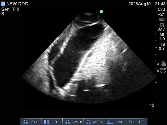 Ultrasound Scans