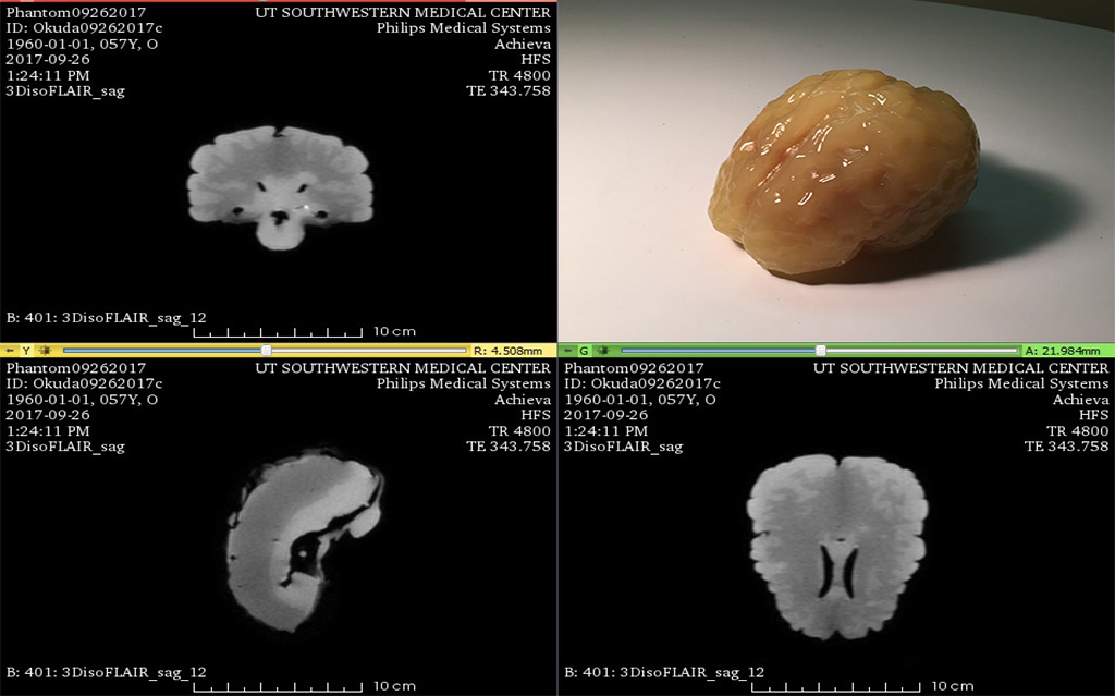 MRI Scans