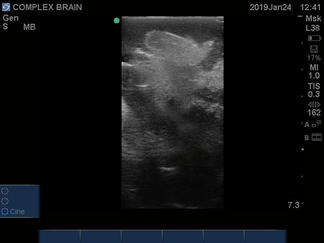 Ultrasound Scans