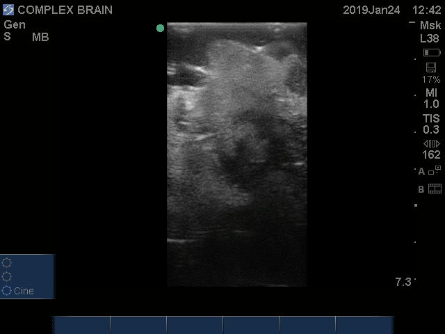 Ultrasound Scans