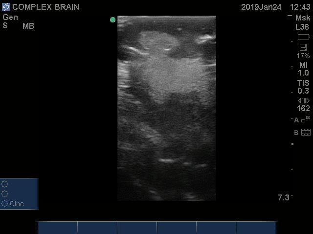 Ultrasound Scans