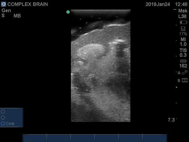 Ultrasound Scans