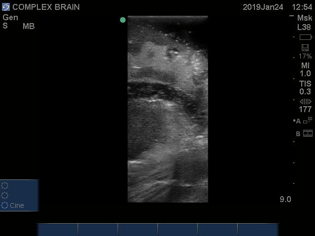 Ultrasound Scans