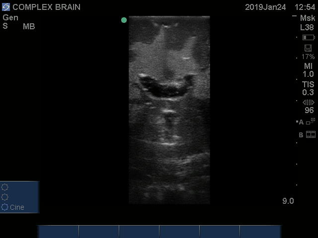 Ultrasound Scans