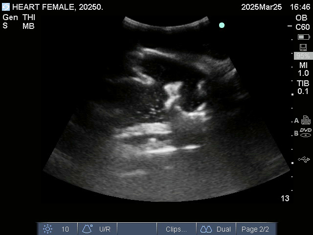 Ultrasound Scans