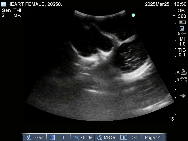 Ultrasound Scans