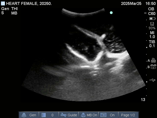 Ultrasound Scans