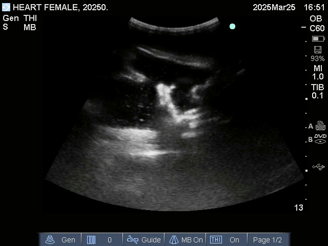 Ultrasound Scans