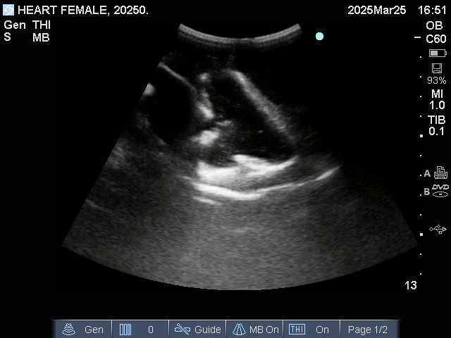 Ultrasound Scans
