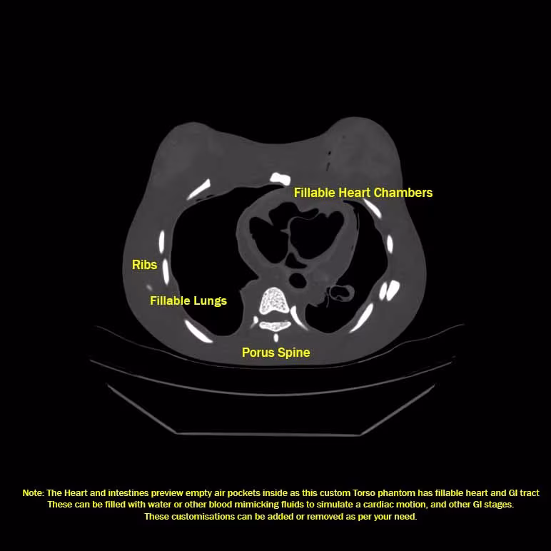 CT Scans