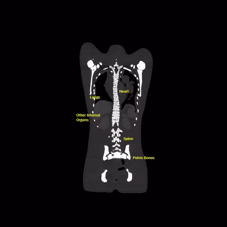 CT Scans