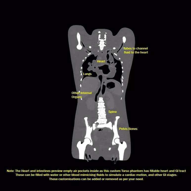 CT Scans