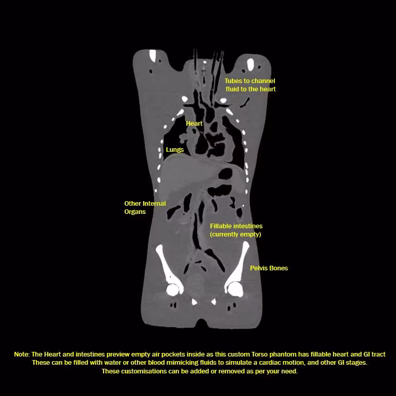 CT Scans