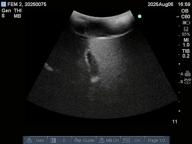Ultrasound Scans
