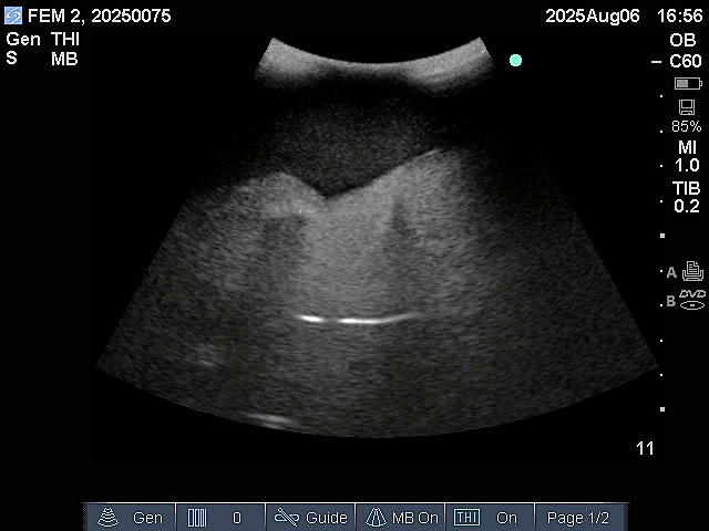 Ultrasound Scans