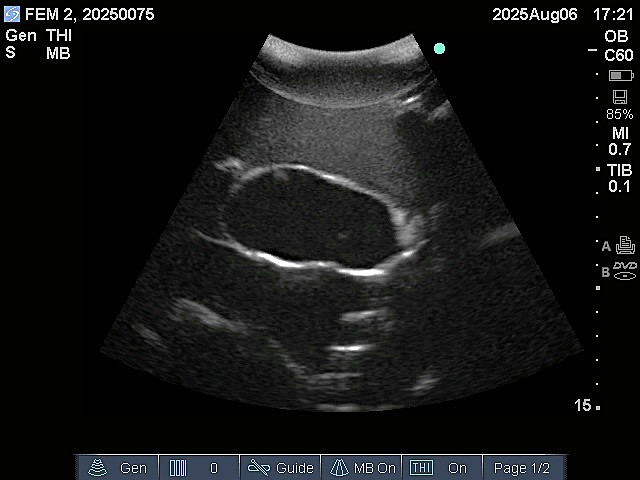 Ultrasound Scans