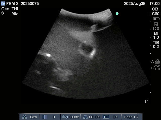 Ultrasound Scans