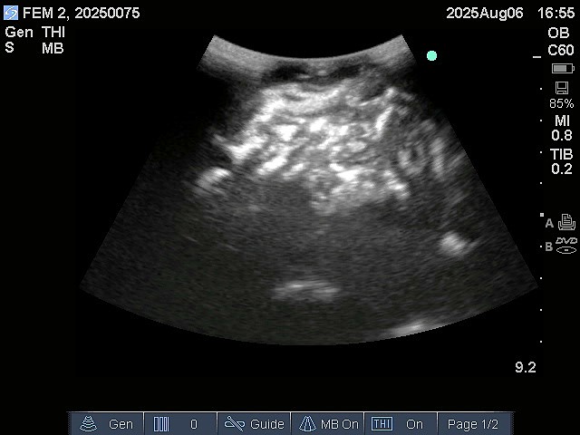 Ultrasound Scans