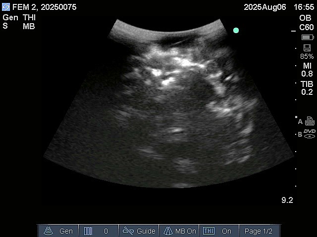 Ultrasound Scans