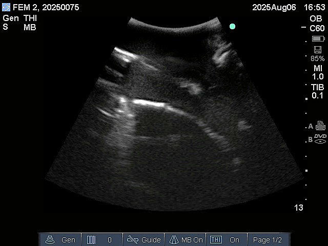 Ultrasound Scans