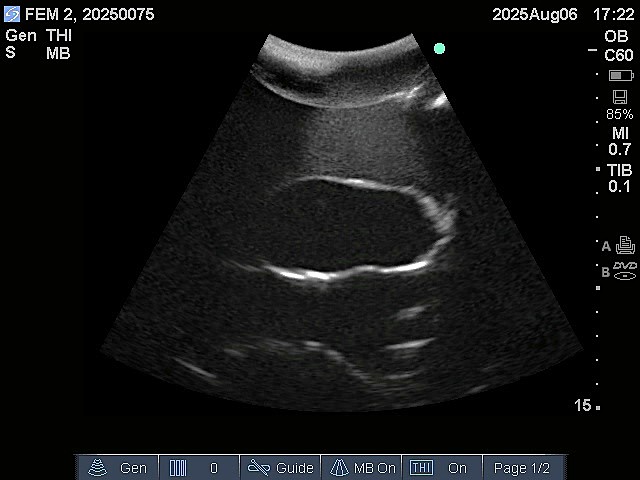 Ultrasound Scans