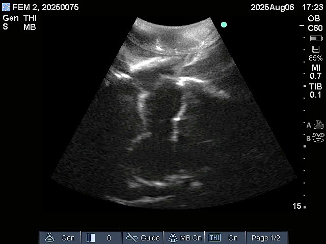 Ultrasound Scans