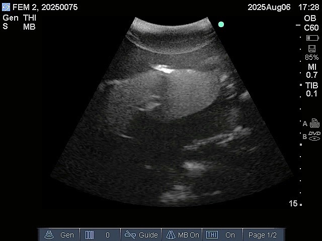 Ultrasound Scans