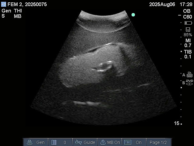 Ultrasound Scans