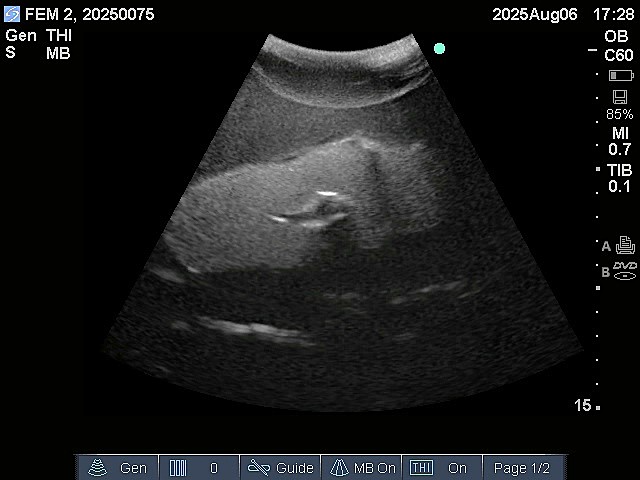 Ultrasound Scans