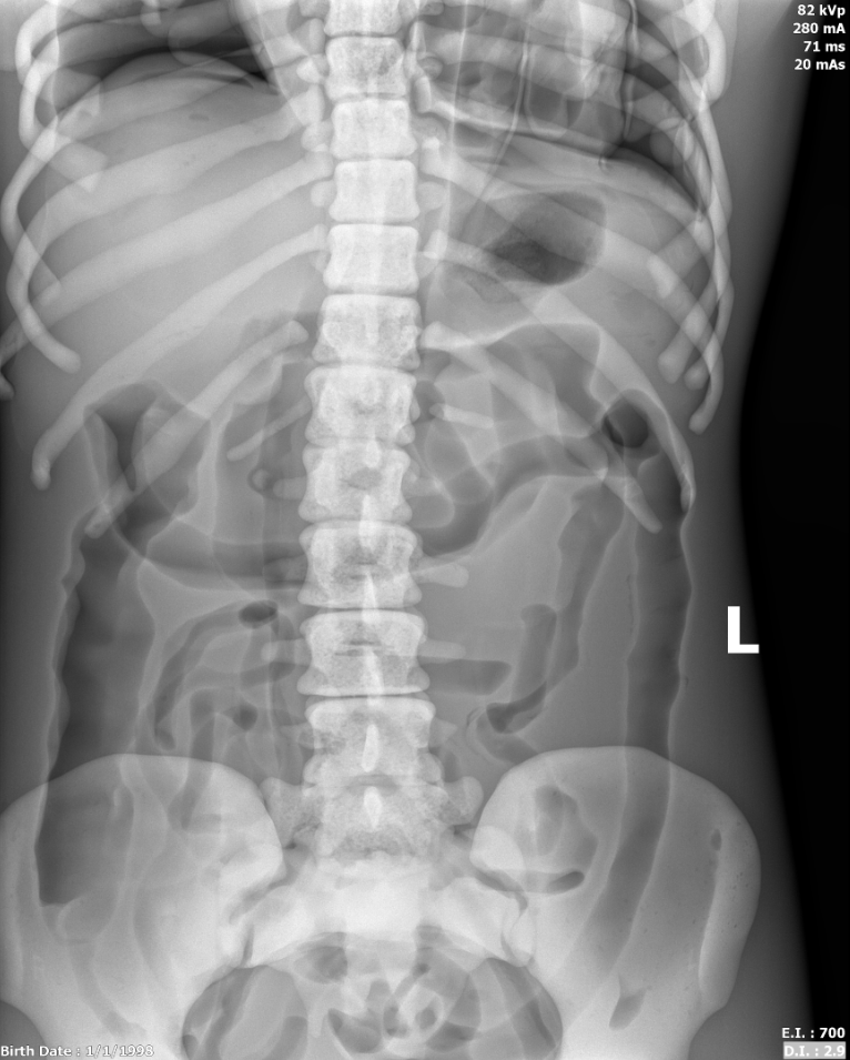 X-Ray Scans