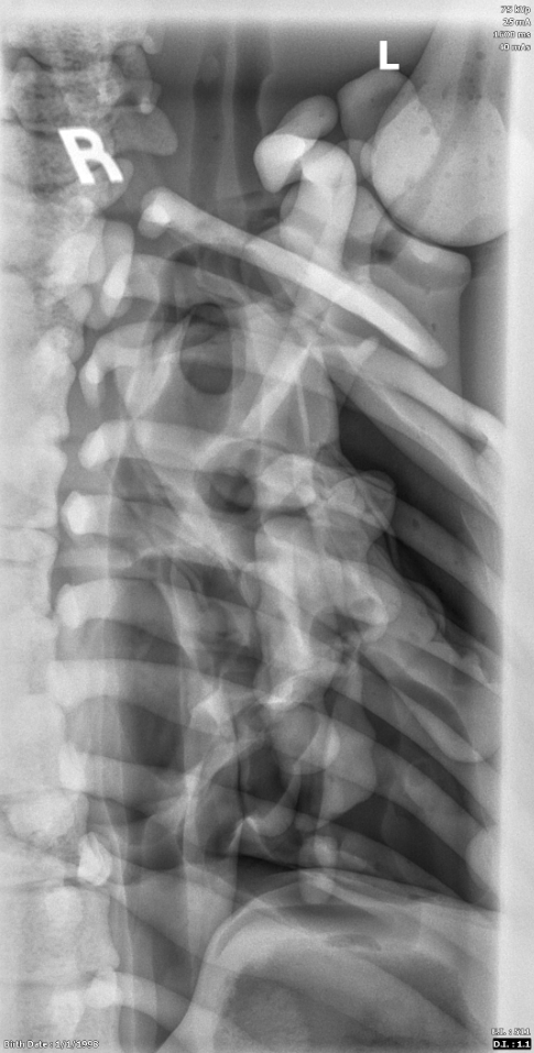X-Ray Scans