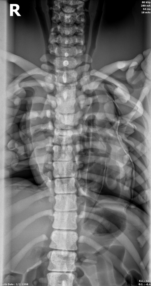 X-Ray Scans