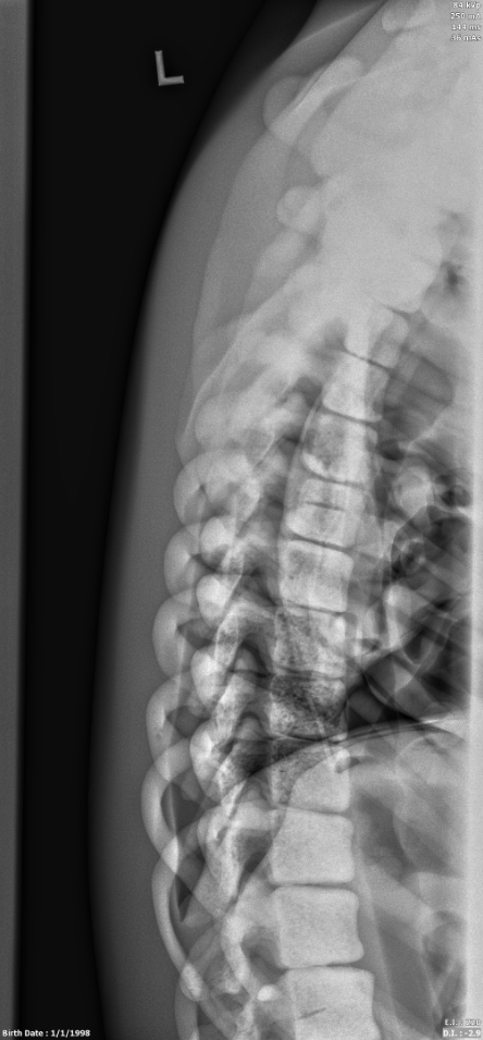 X-Ray Scans