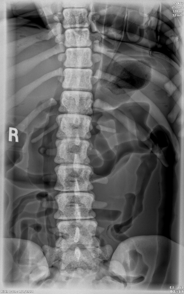 X-Ray Scans