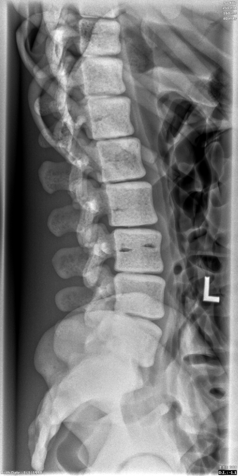 X-Ray Scans