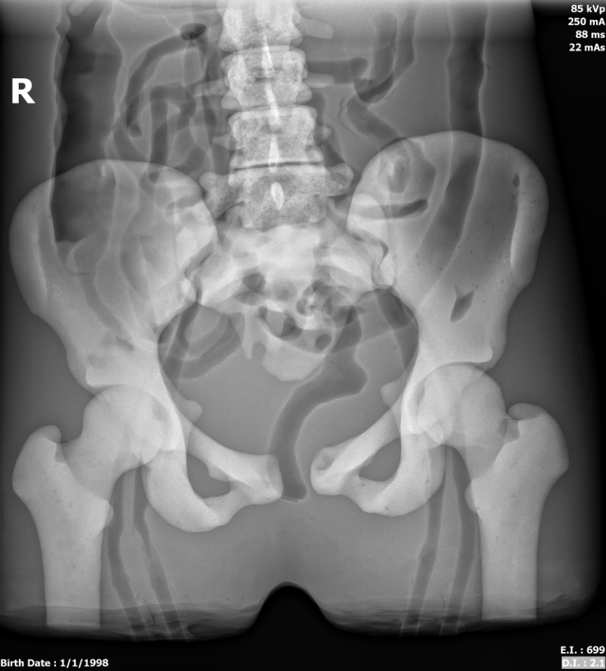 X-Ray Scans