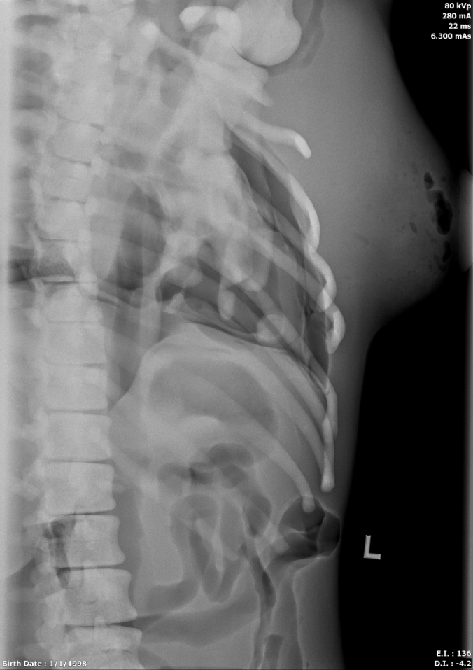 X-Ray Scans