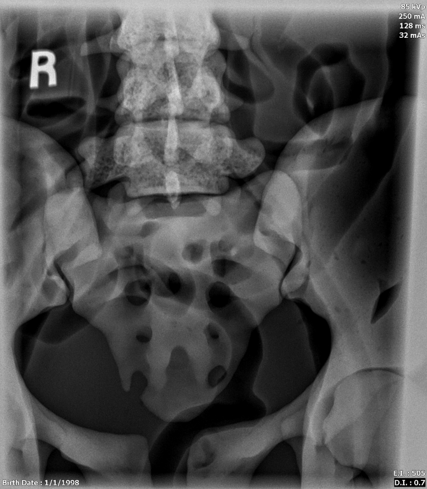 X-Ray Scans