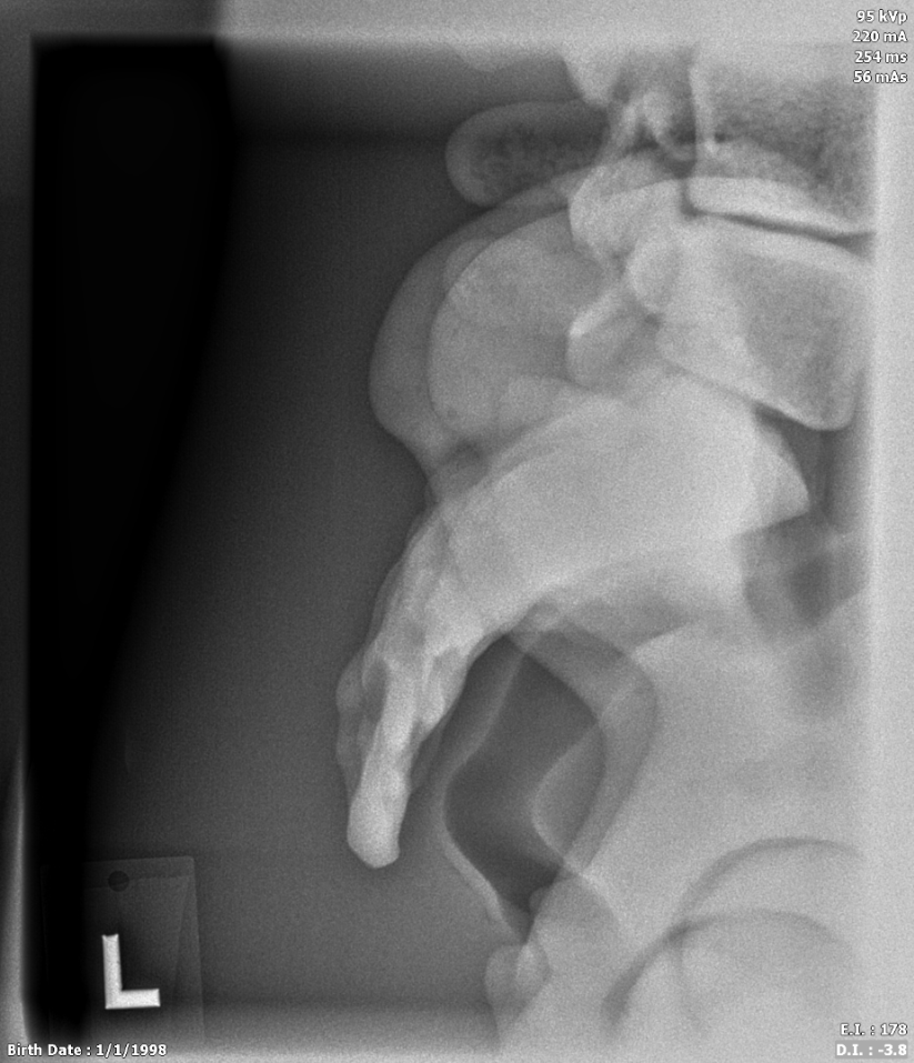 X-Ray Scans