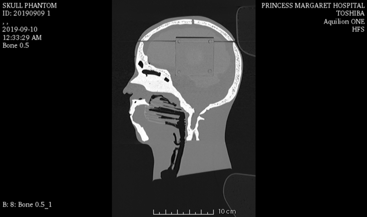 CT Scans