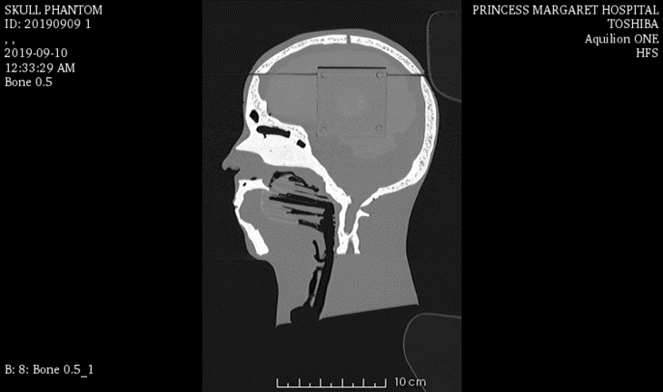CT Scans