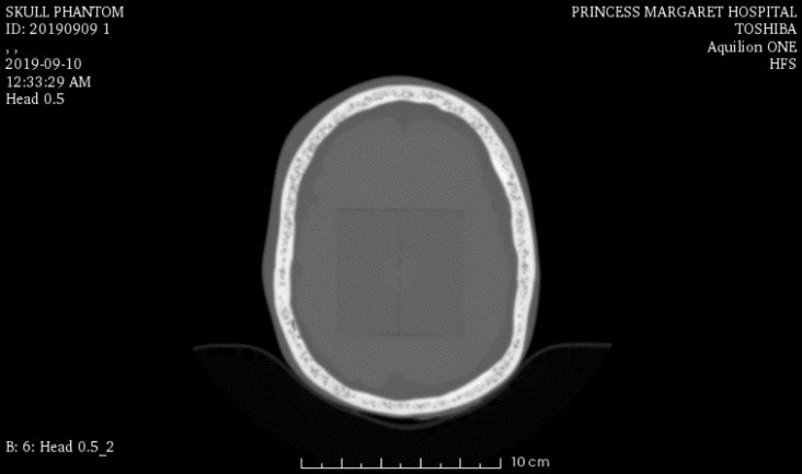 CT Scans