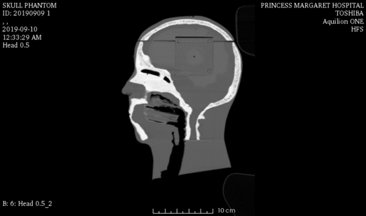 CT Scans