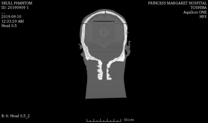 CT Scans