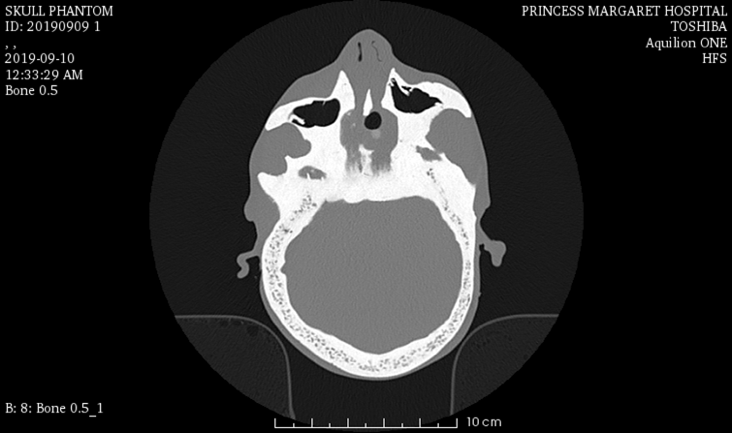 CT Scans