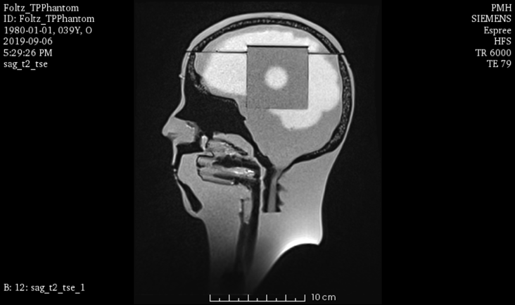 MRI Scans